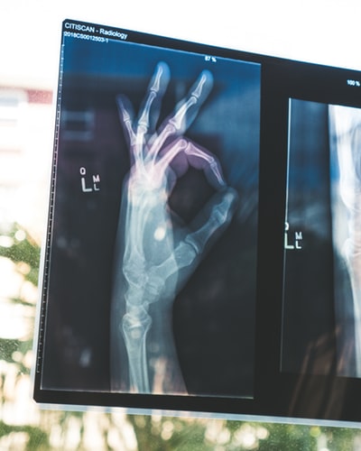 Perfect sign with hand on x-ray image